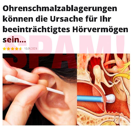 Externe Grafik aus der Mail, bei Imgur gehostet: Ohrenschmalzablagerungen können die Ursache für Ihr beeinträchtigtes Hörvermögen sein