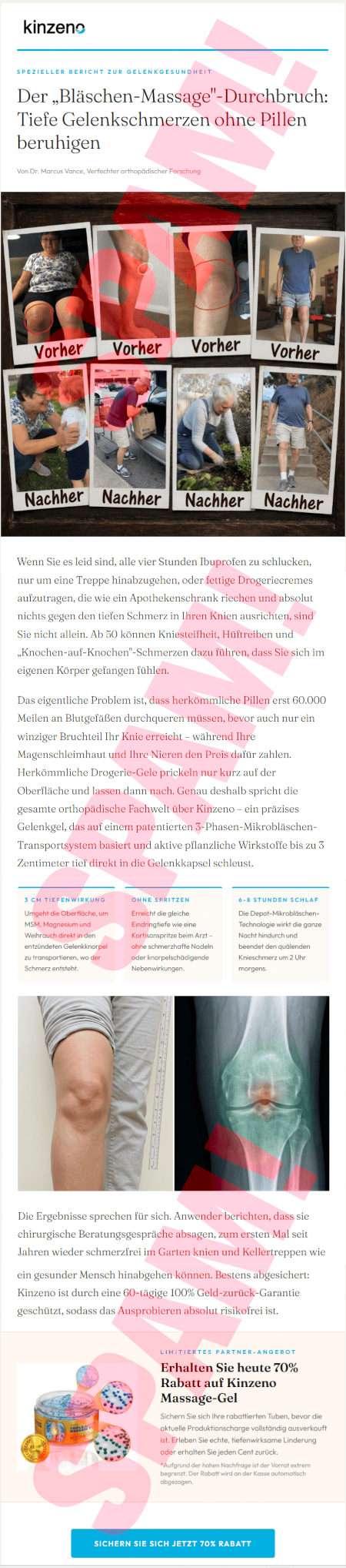 kinzeno-Logo -- Spezieller Bericht zur Gelenkgesundheit -- Der »Bläschen-Massage«-Durchbruch: Tiefe Gelenkschmerzen ohne Pillen beruhigen -- Von Dr. Marcus Vance, Verfechter orthopädischer Forschung -- Abbildungen Vorher/Nachher -- Wenn Sie es leid sind, alle vier Stunden Ibuprofen zu schlucken, nur um eine Treppe hinabzugehen, oder fettige Drogeriecremes aufzutragen, die wie ein Apothekenschrank riechen und absolut nichts gegen den tiefen Schmerz in Ihren Knien ausrichten, sind Sie nicht allein: Ab 50 können Kniesteifheit, Hüftreiben und »Knochen-auf-Knochen«-Schmerzen dazu führen, dass Sie sich im eigenen Körper gefangen fühlen. -- Das eigentliche Problem ist, dass herkömmliche Pillen erst 60.000 Meilen an Blutgefäßen durchqueren müssen, bevor auch nur ein winziger Bruchteil Ihr Knie erreicht, während Ihre Magenschleimhaut und Ihre Nieren den Preis dafür zahlen. Herkömmliche Drogerie-Gee prickeln nur kurz auf der Oberfläche und lassen dann nach. Genau deshalb spricht die gesamte orthopädische Fachwelt über Kinzeno, ein präzises Gelenkgel, das auf einen patentierten 3-Phasen-Mikrobläschen-Transportsystem basiert und aktive pflanzliche Wirkstoffe bis zu 3 Zentimeter tief direkt in die Gelenkkapsel schleust. -- 3 cm Tiefenwirkung: Umgeht die Oberfläche, um MSM, Magnesium und Weihrauch direkt in den entzündeten Gelenkknorpel zu transportieren, wo der Schmerz entsteht -- Ohne Spritzen: Erreicht die gleiche Eindringtiefe wie eine Kortisonspritze beim Arzt, ohne schmerzhafte Nadeln oder körperschädigende Nebenwirkungen -- 6-8 Stunden Schlaf: Die Depot-Mikrobläschen-Technologie wirkt die ganze Nacht hindurch und beendet den quälenden Knieschmerz um 2 Uhr morgens. -- Pseudowissenschaftliche Abbildungen aus dem Handbuch der Quacksalberei -- Die Ergebnisse sprechen für sich. Anwender berichten, dass sie chirurgische Beratungsgesprche absagen, zum ersten Mal seit Jahren wieder schmerzfrei im Garten knien und Kellertreppen wie ein gesunder Mensch hinabgehen können. Bestens abgesichert: Kinzeno ist durch eine 60-tägige 100% Geld-zurück-Garantie geschützt, sodass das Ausprobieren absolut risikorei ist. -- Pseudowissenschatliche Abbildung -- Limitiertes Partner-Angebot -- Erhalten Sie heute 70% Rabatt auf Kinzeno Massage-Gel -- Sichern Sie sich ihre rabattfreien Tuben, bevor die aktuelle Produktionscharge vollständig ausverkauft ist. Erleben Sie echte, tiefenwirksame Linderung oder erhalten Sie jeden Cent zurück. -- Aufgrund der hohen Nachfrage ist der Vorrat extrem begrenzt. Der Rabatt wird an der Kasse automatisch abgezogen. -- [Sichern Sie sich jetzt 70% Rabatt]